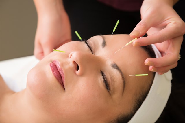 (logo) acupuncture